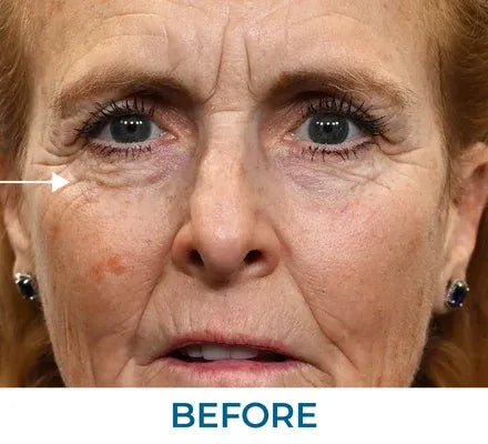 Skin appearance before use