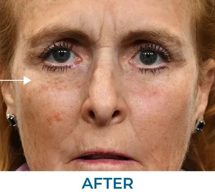 Skin appearance after use
