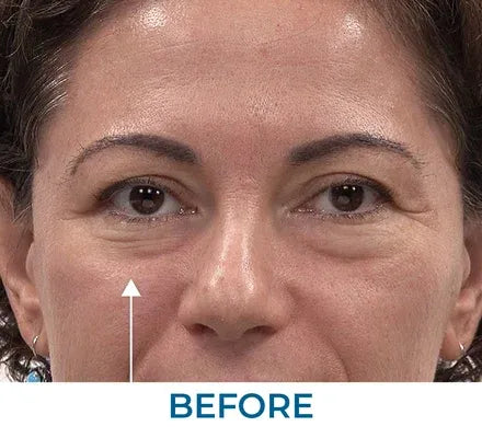 Skin appearance before use
