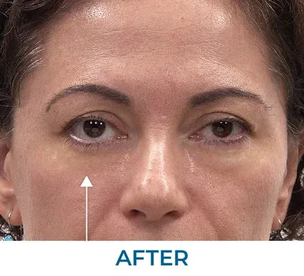 Skin appearance after use
