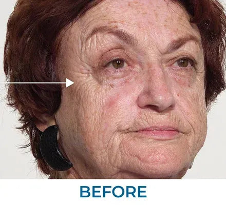 Skin appearance before use