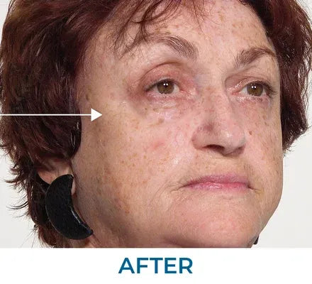 Skin appearance after use