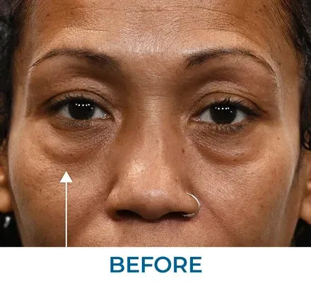 Skin appearance before use