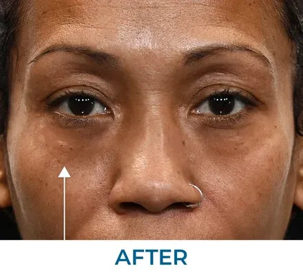 Skin appearance after use