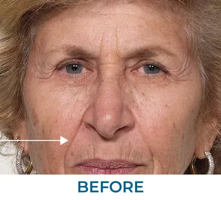 Skin appearance before use