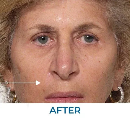 Skin appearance after use